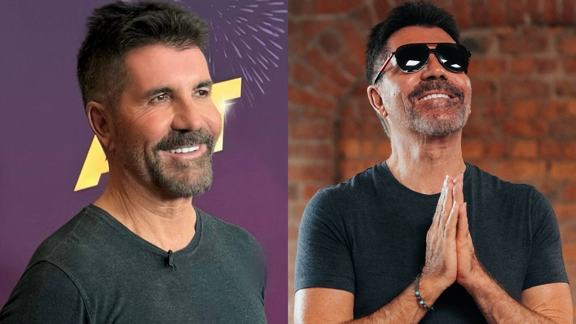 simon cowell teeth